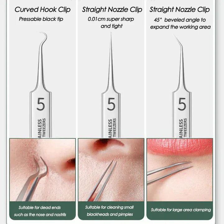 Perofessional Facial Blackheads Remover
