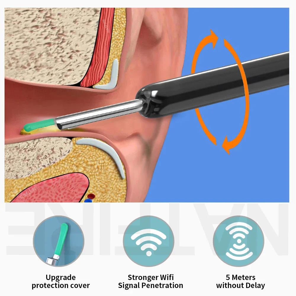 Wireless Endoscope Hd Ear Pick Set