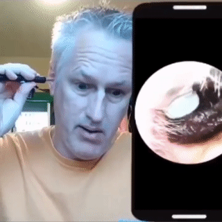 Wireless Endoscope Hd Ear Pick Set