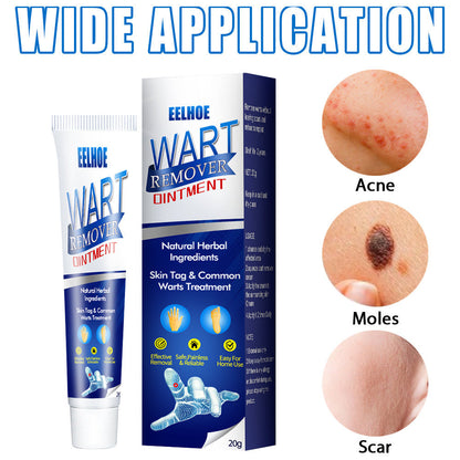 Wart Remover Cream Fast & Effective