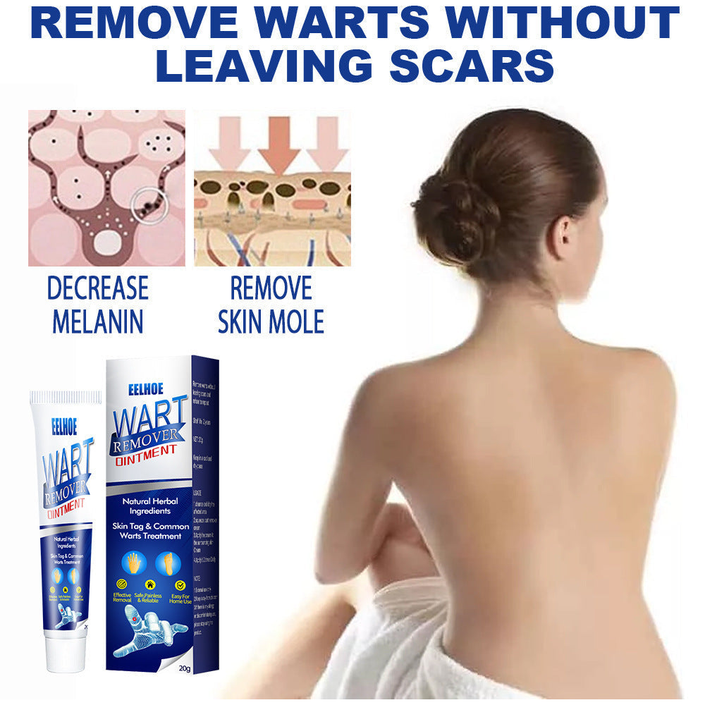 Wart Remover Cream Fast & Effective