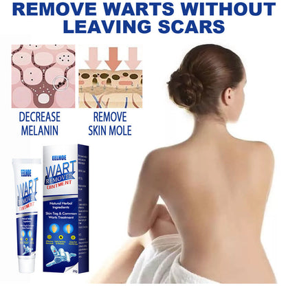Wart Remover Cream Fast & Effective