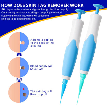 Skin Tag Removal Kit
