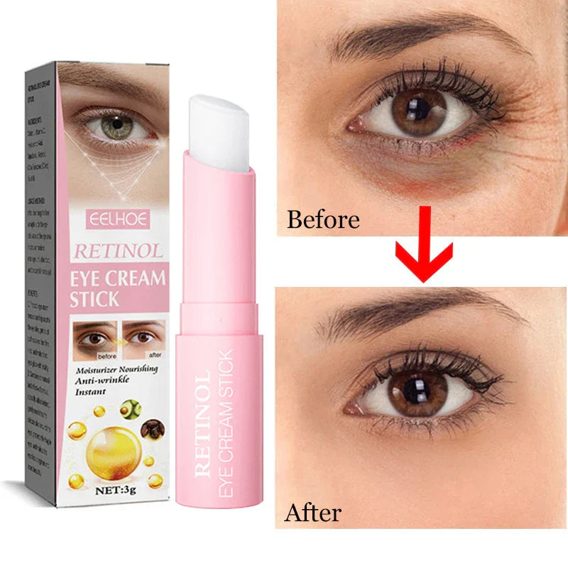 Retinol Eye Cream Instant Removing Eyes Wrinkle