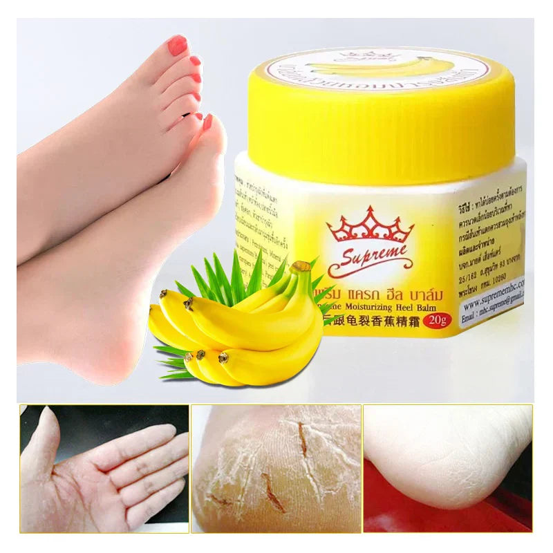 Dead Skin Remover Crack Cream