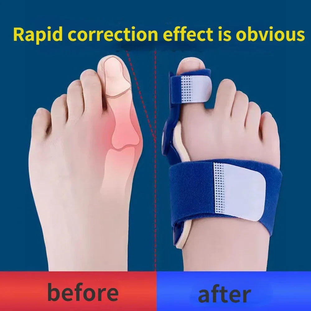 Flexfix Toe Splint