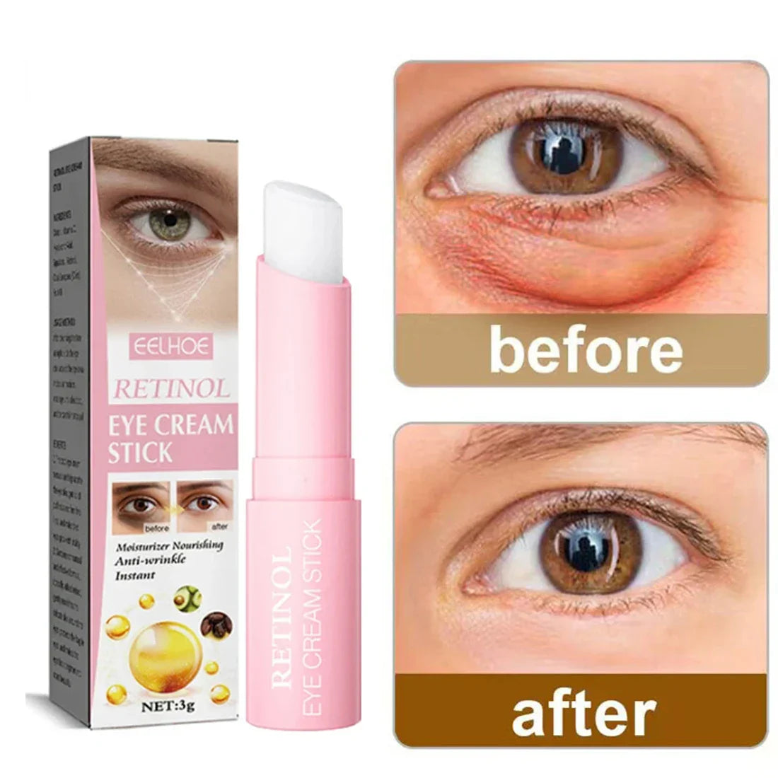 Retinol Eye Cream Instant Removing Eyes Wrinkle