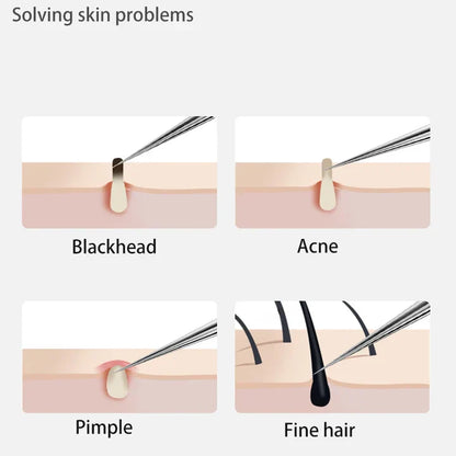 Perofessional Facial Blackheads Remover