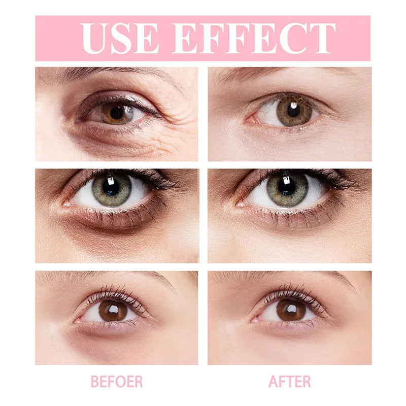 Retinol Eye Cream Instant Removing Eyes Wrinkle