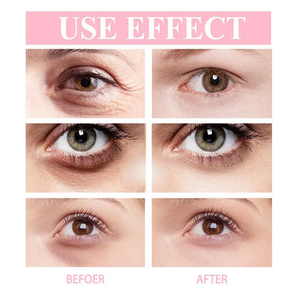 Retinol Eye Cream Instant Removing Eyes Wrinkle