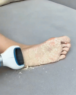 Usb Foot Callus Remover Pedicure Tool