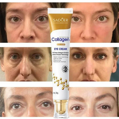 Instant Eye Bag Removal